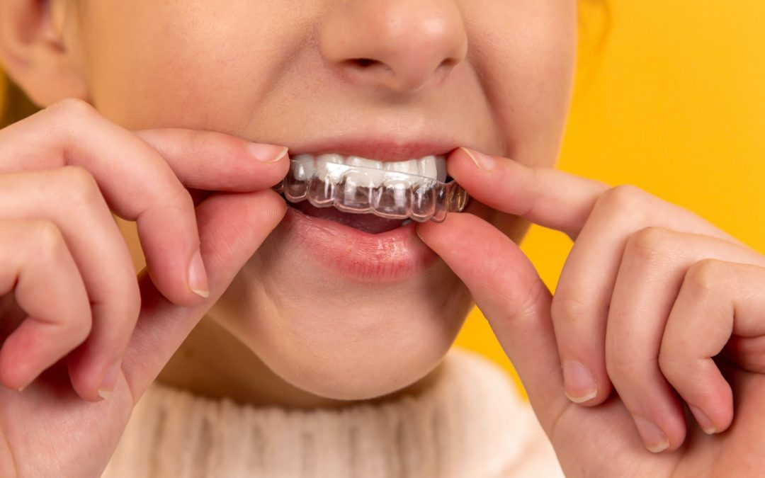 5 Ways Invisible Braces are Better than Metal Braces